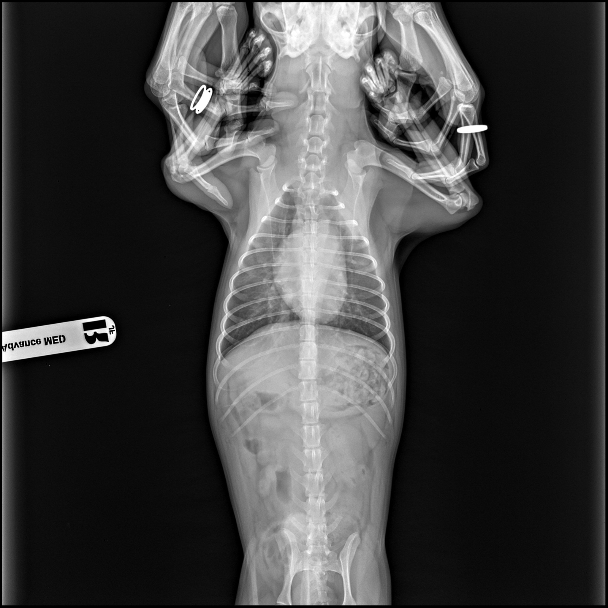 X-ray Image