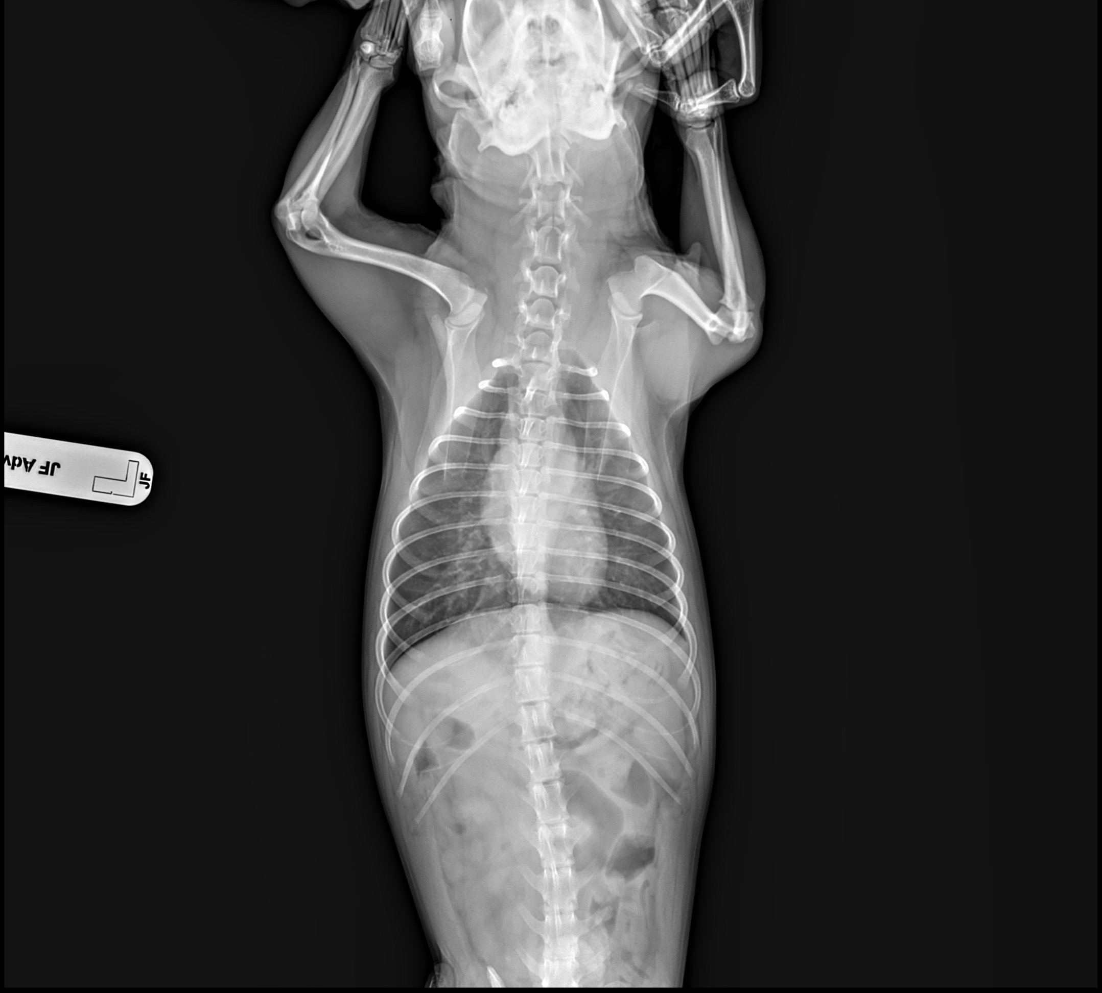 X-ray Image