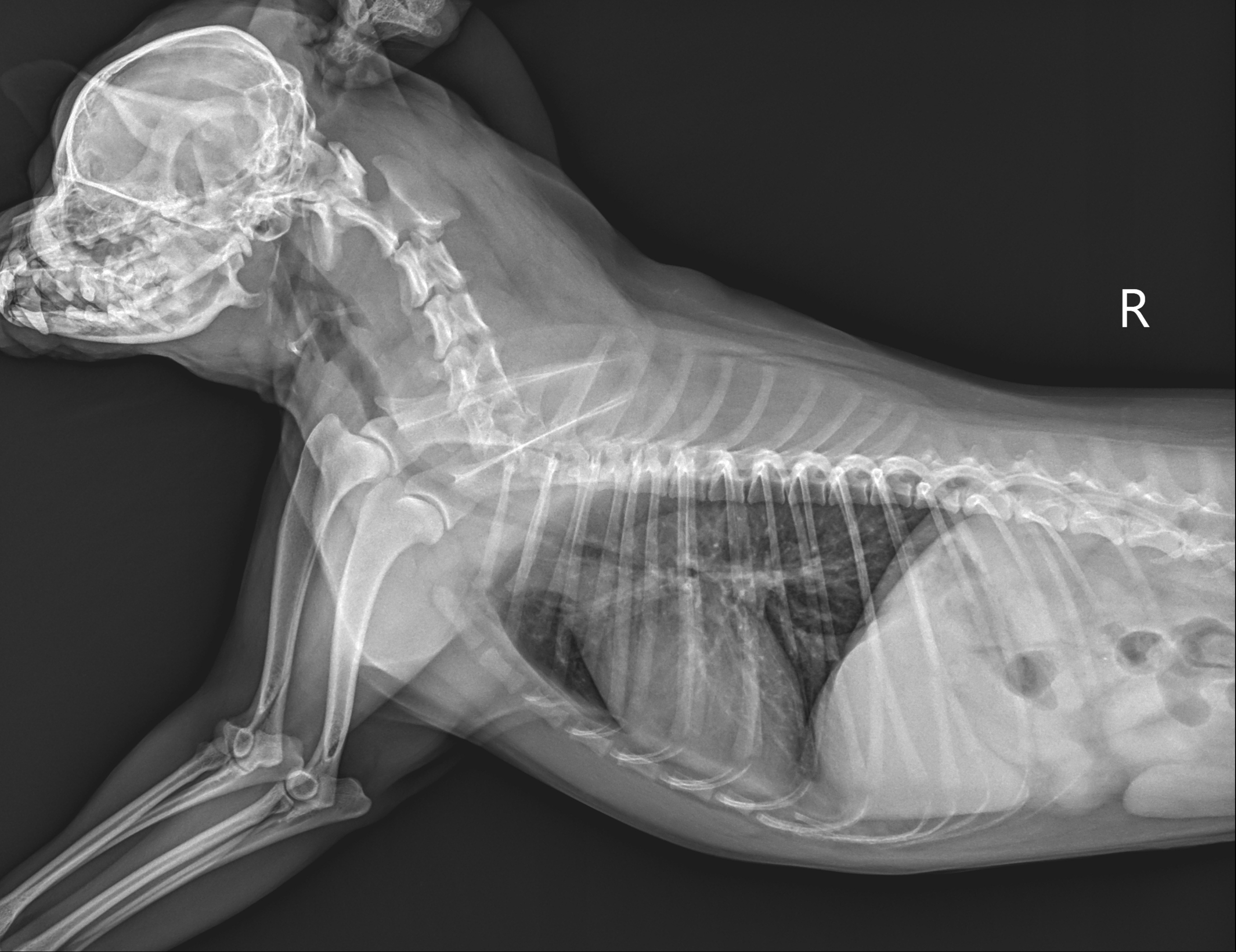 X-ray Image