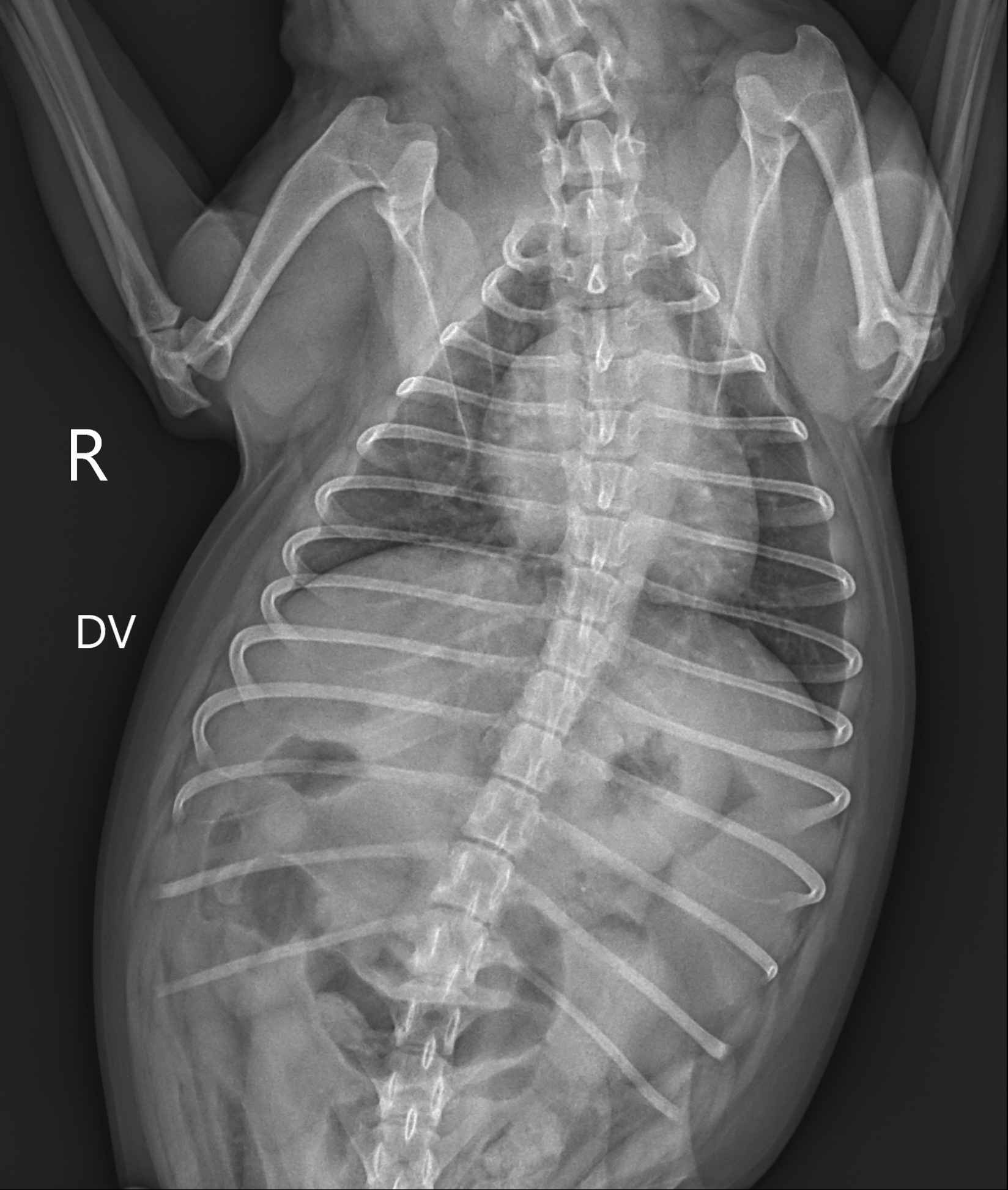 X-ray Image