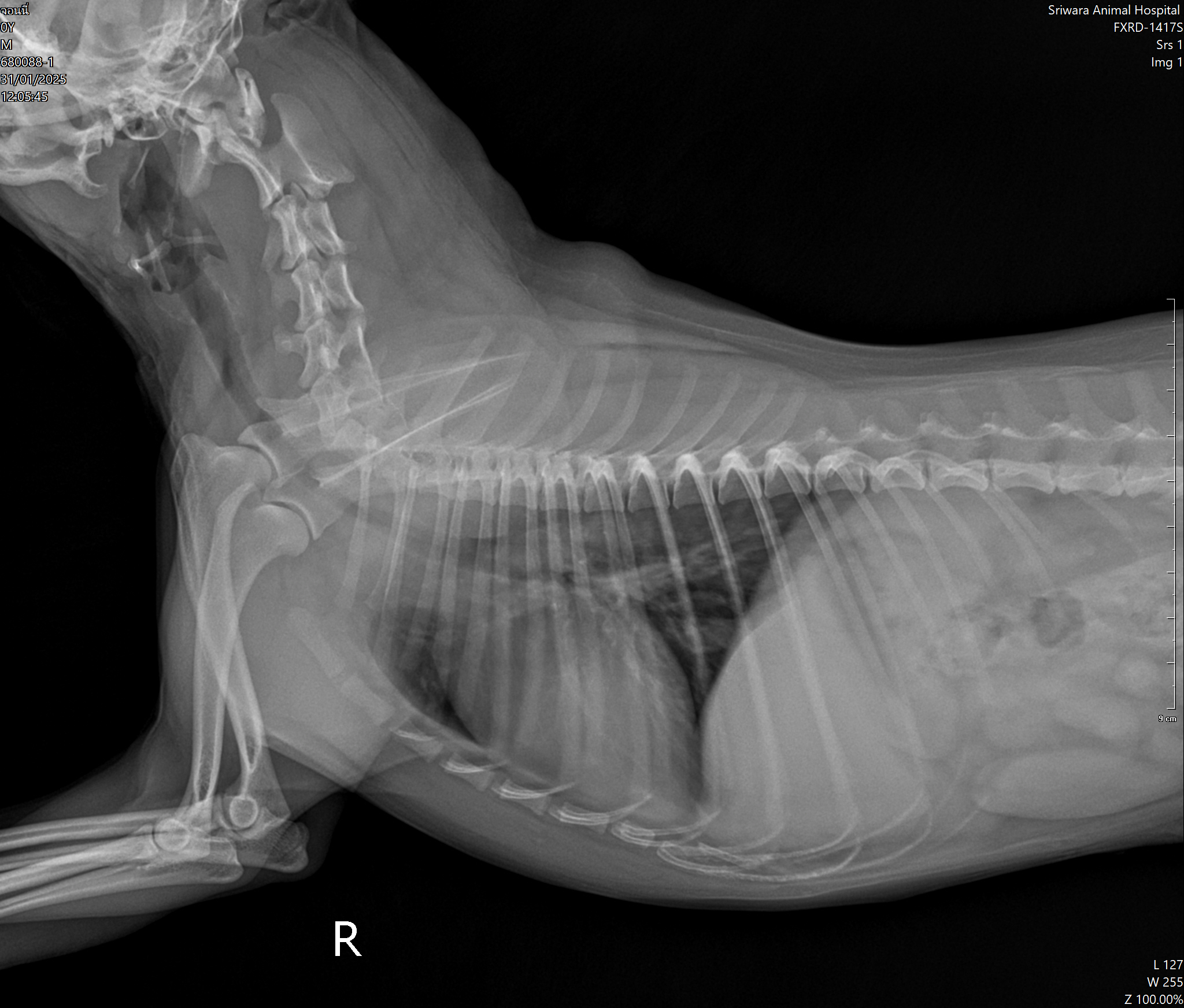 X-ray Image