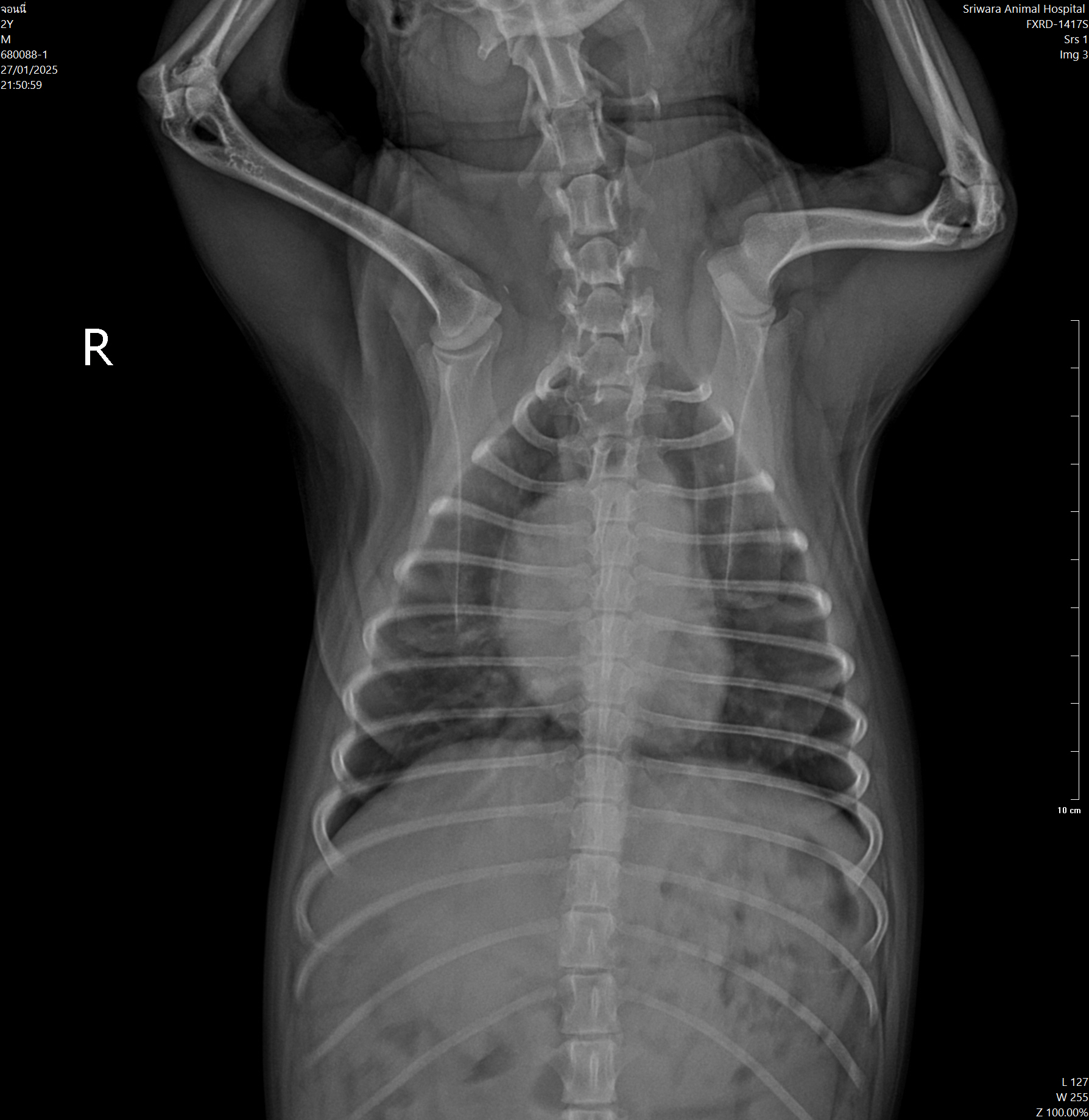 X-ray Image